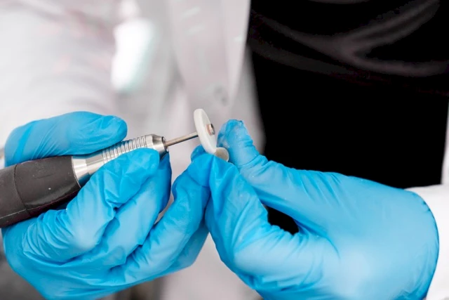 Diş İmplantı Tedavisi Hakkında Sıkça Sorulan Sorular