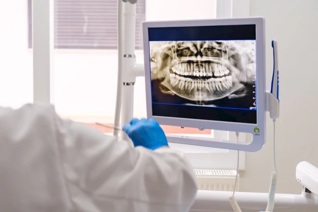 Diş Temizliği - Diş Taşı Temizliği ve Parlatma Nedir?