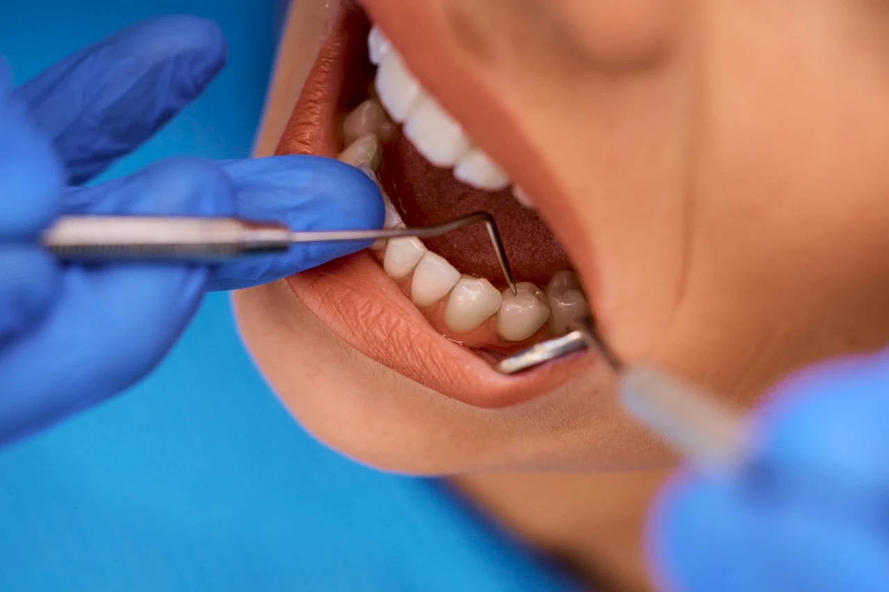 Alles, was Sie über Emax-Kronen wissen müssen: Ein umfassender Leitfaden von White Dental Turkey
