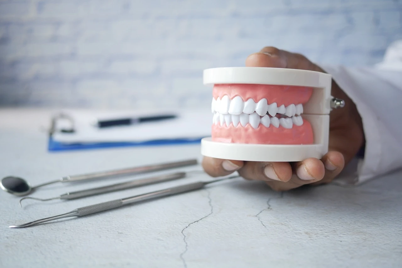 Häufige Zahnerkrankungen verstehen: Ursachen, Symptome und Vorbeugung / White Dental Türkei