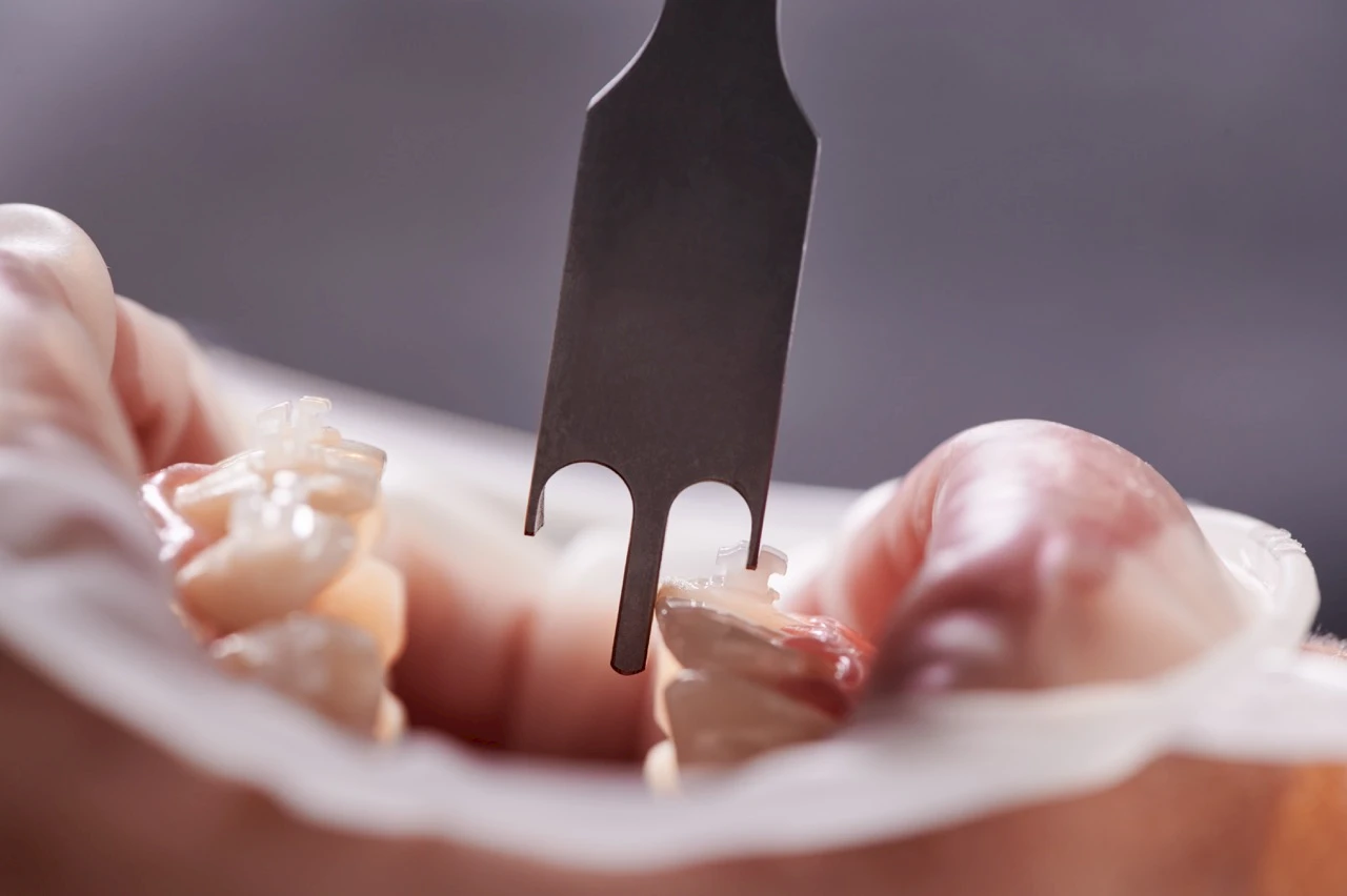 Zirkonoxidkronen Preis in der Türkei